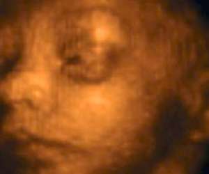 ultrasound of human fetus as 28 weeks and 3 days