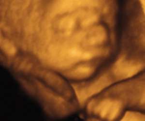 ultrasound of human fetus as 28 weeks and 4 days
