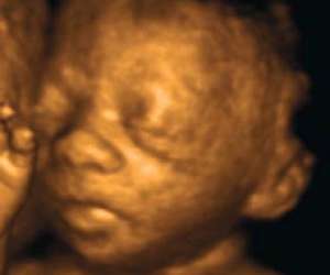 ultrasound of human fetus as 28 weeks and 5 days