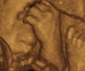 ultrasound of human fetus 29 weeks and 4 days