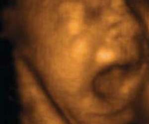 ultrasound of human fetus 30 weeks and 1 day