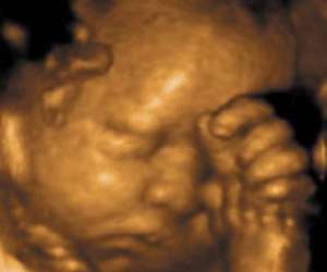 ultrasound of human fetus 31 weeks and 3 days