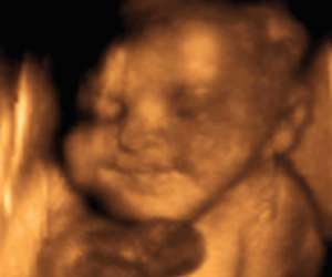 ultrasound of human fetus 32 weeks and 3 days
