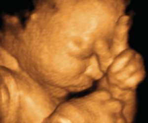 ultrasound of human fetus at 33 weeks and 2 days