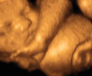 ultrasound of human fetus at 33 weeks and 5 days