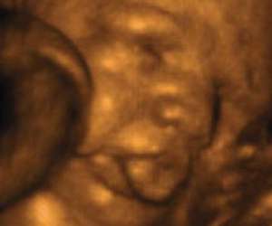 ultrasound of human fetus at 34 weeks and 3 days