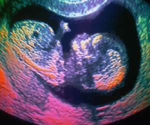 ultrasound of human fetus 35 weeks and 3 days