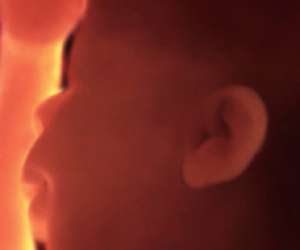 ultrasound of human fetus 36 weeks and 4 days
