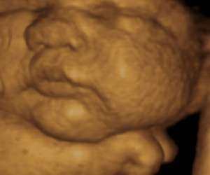 ultrasound of human fetus 38 weeks and 3 days