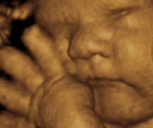 ultrasound of human fetus 38 weeks and 4 days