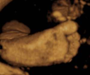 ultrasound of human fetus 38 weeks and 6 days
