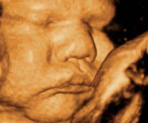 ultrasound of human fetus 39 weeks and 1 day