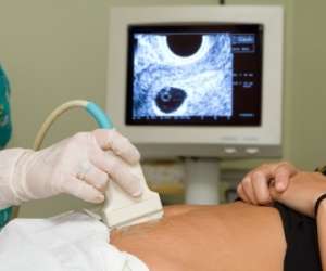 Tubal Pregnancy